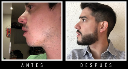 Bálsamo para barba y bigote