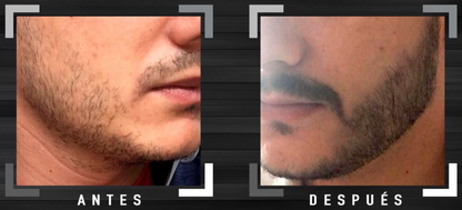 Bálsamo para barba y bigote
